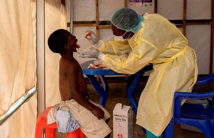 México Emite Aviso Epidemiológico por Mpox: 49 Casos Confirmados hasta Agosto 2024